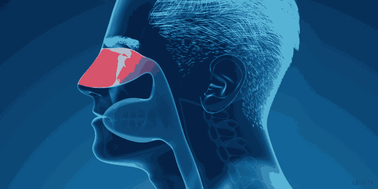 Can Sinusitis Be Caused by a Cold or Flu