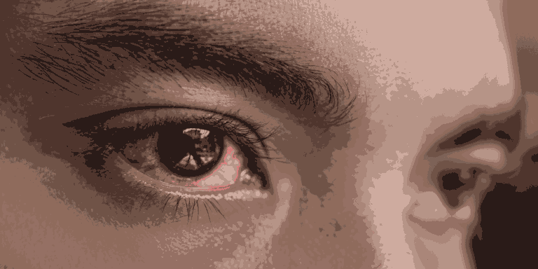 pink eye conjunctiva anatomy