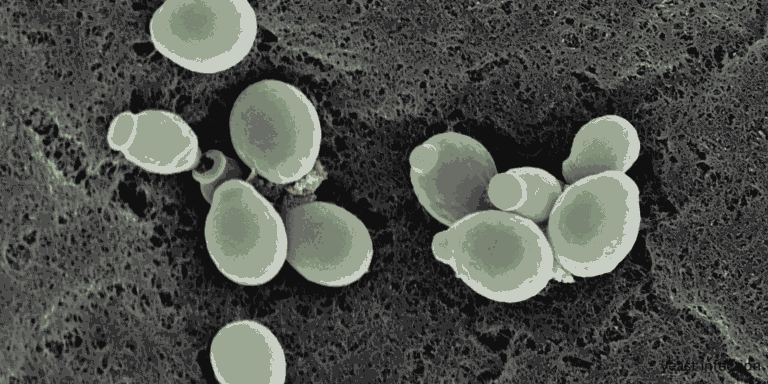 yeast infection treatment