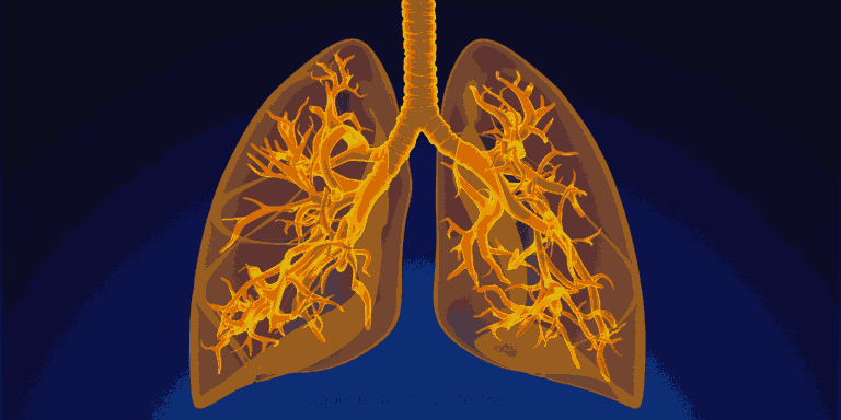 upper respiratory infection