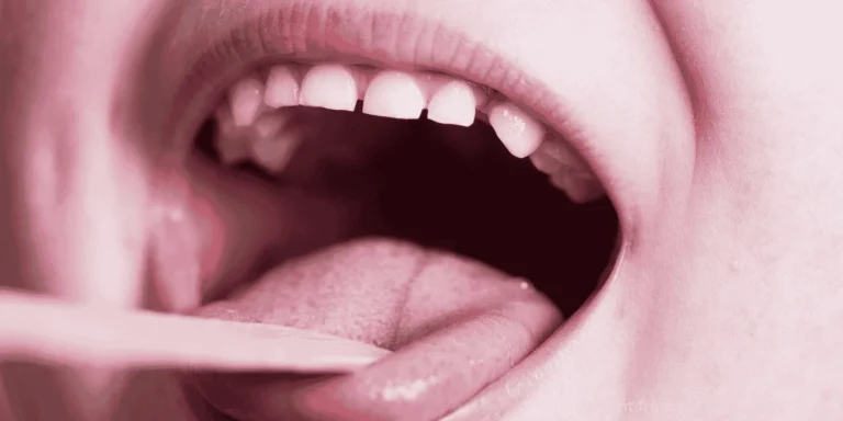 prevent frequent throat infections